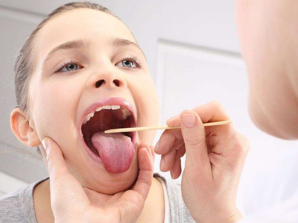 Tonsils