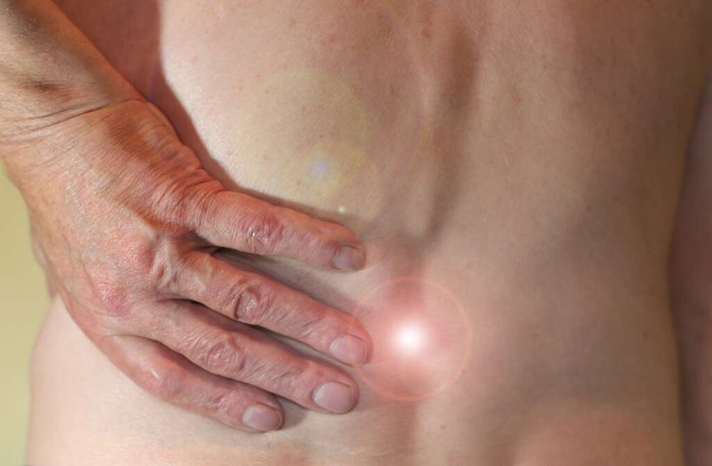 Avascular Necrosis