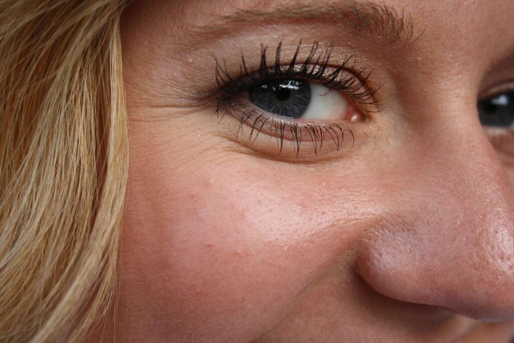 ACV