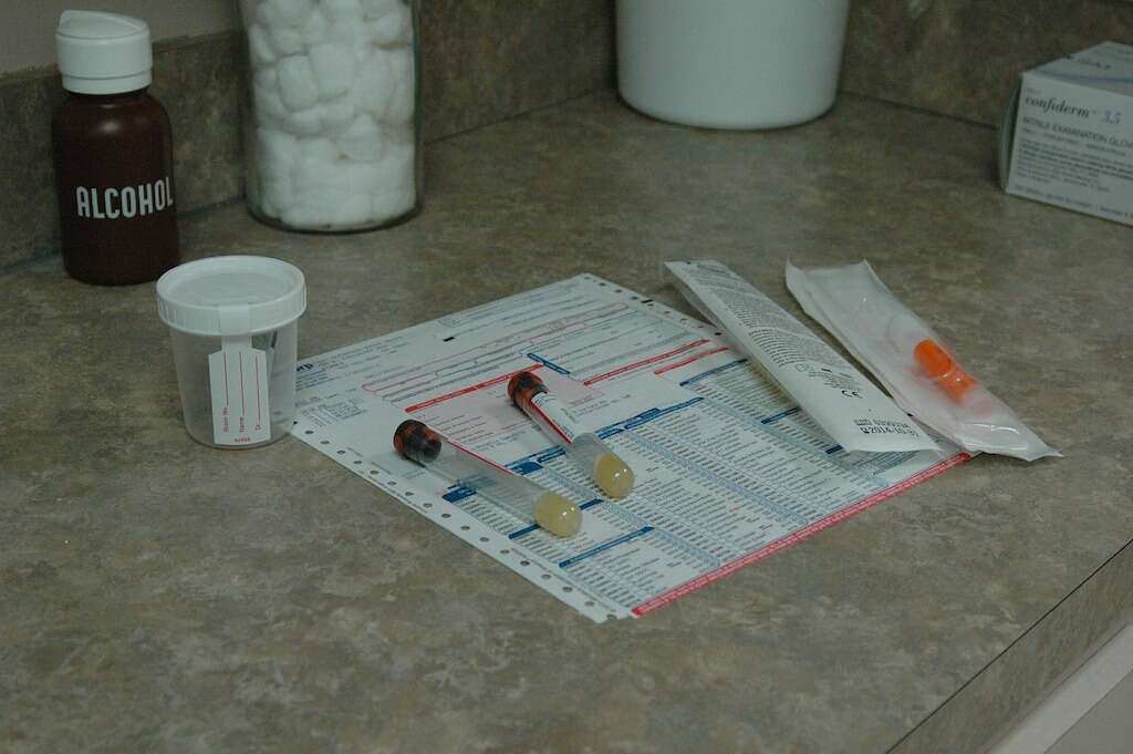 Bloody Urine