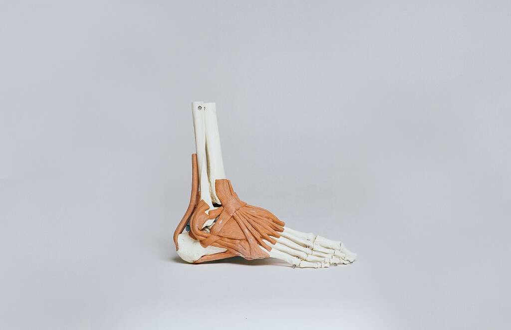 Charcot Foot
