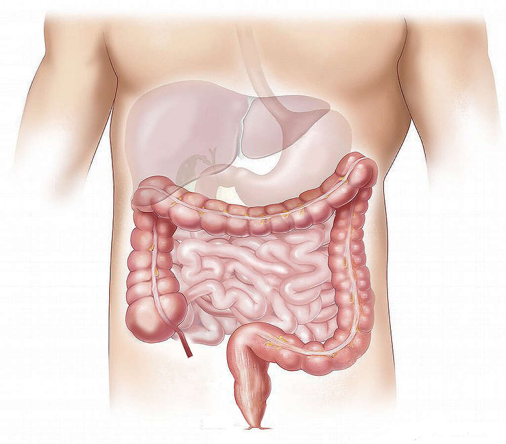 Pain In Lower Left Quadrant