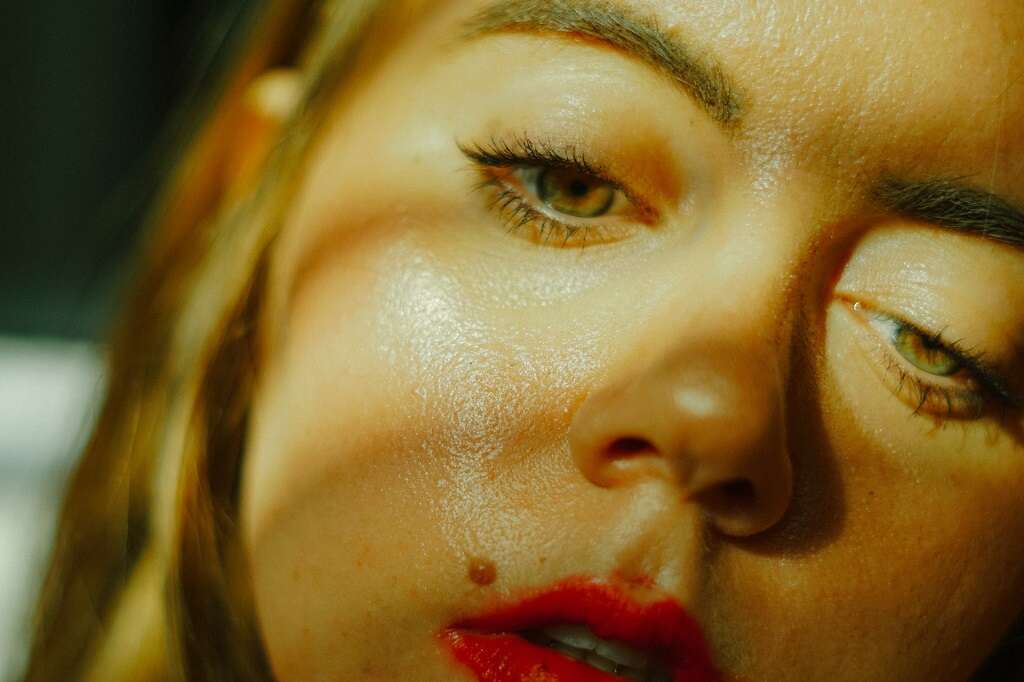 Dengue