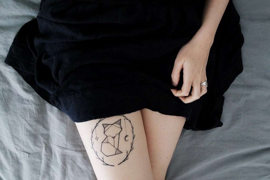Elephantiasis
