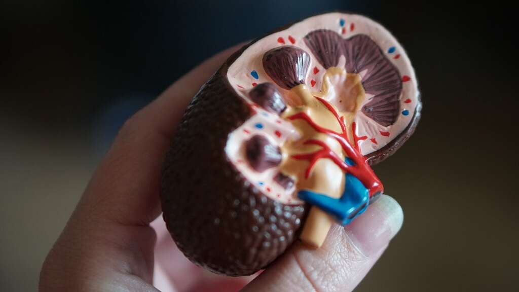 Elephantiasis