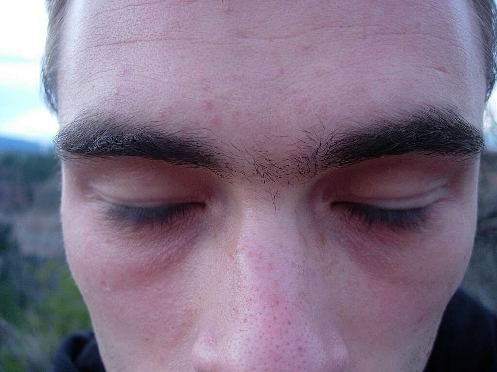 Eyes