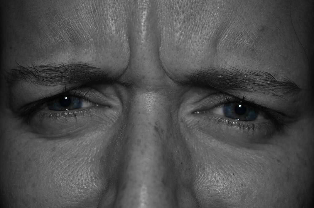 Eye Ulcers