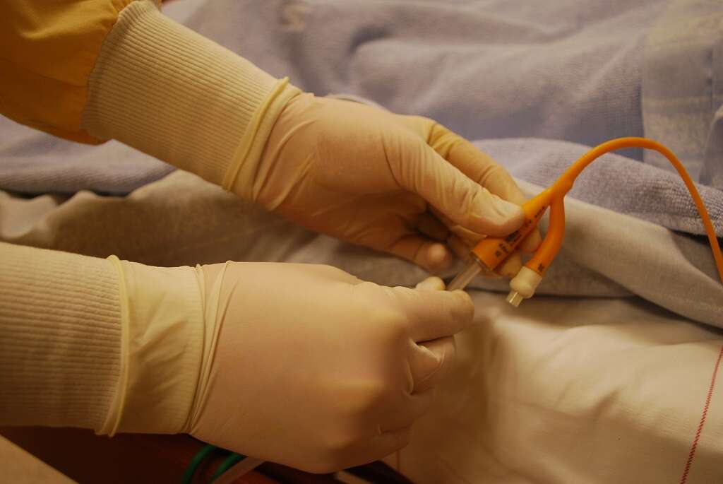 Peritoneum