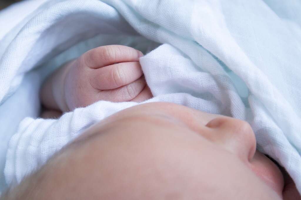 Galactosemia