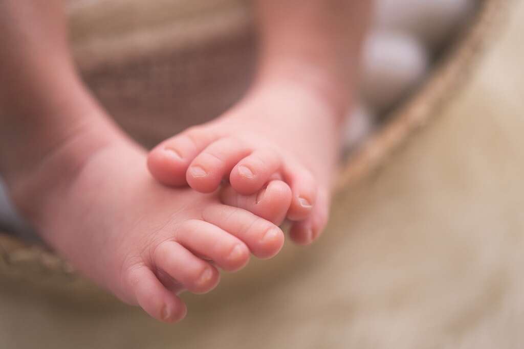 Hammer Toe