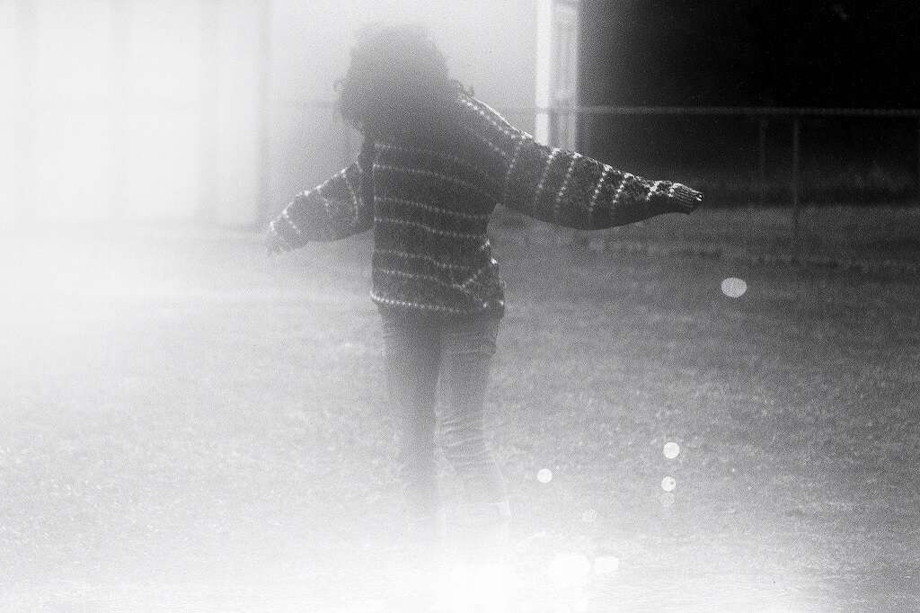 Hypersomnia