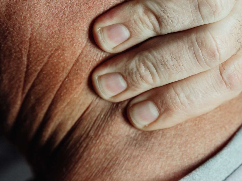 Ischemia