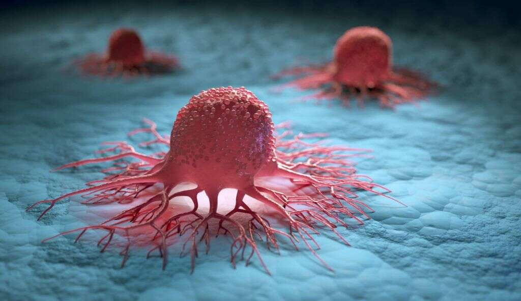 Lung Cancer