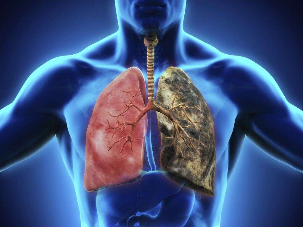 Common Cancers