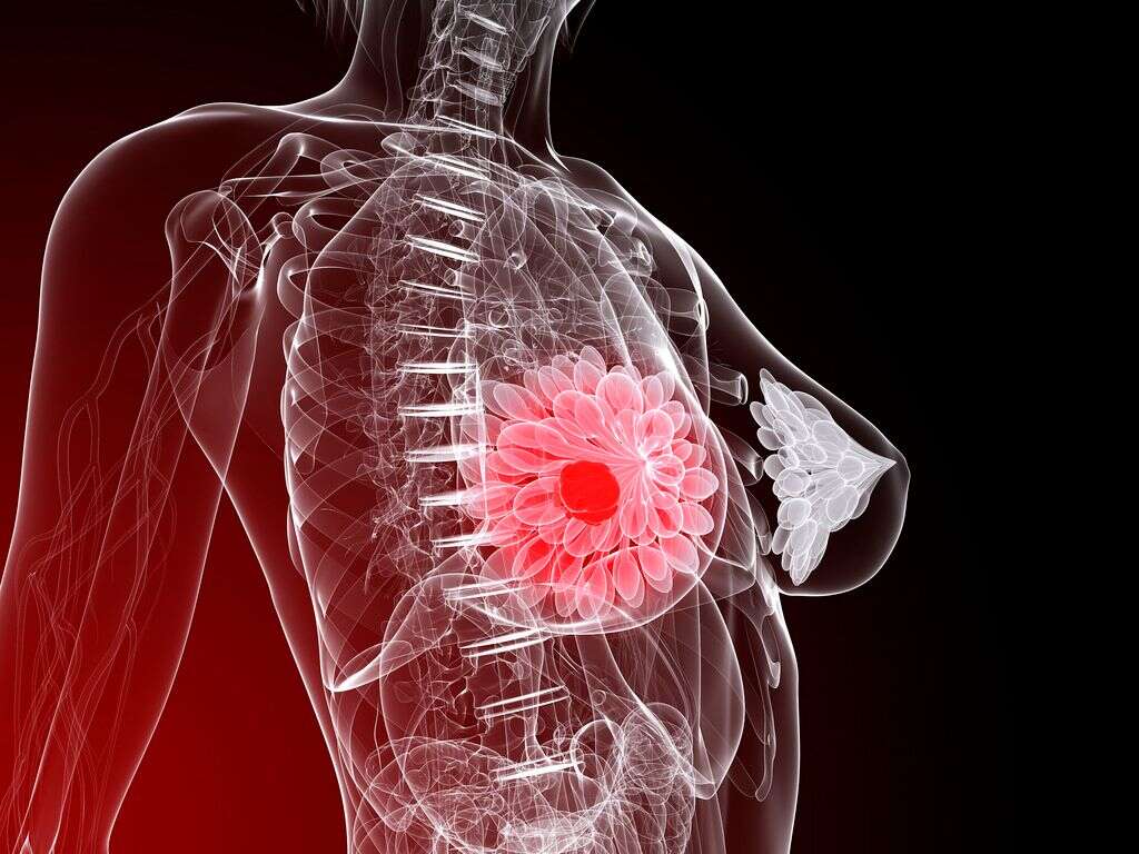 Common Cancers