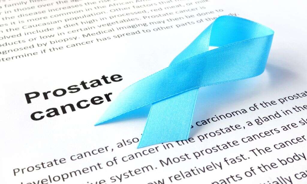 Common Cancers