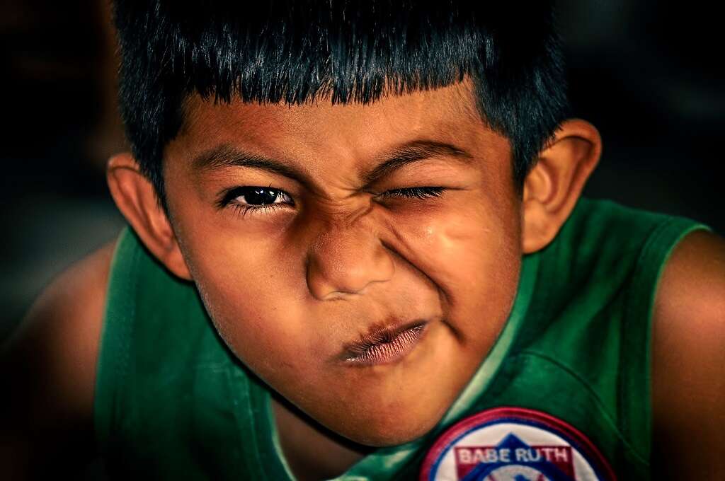 Moyamoya