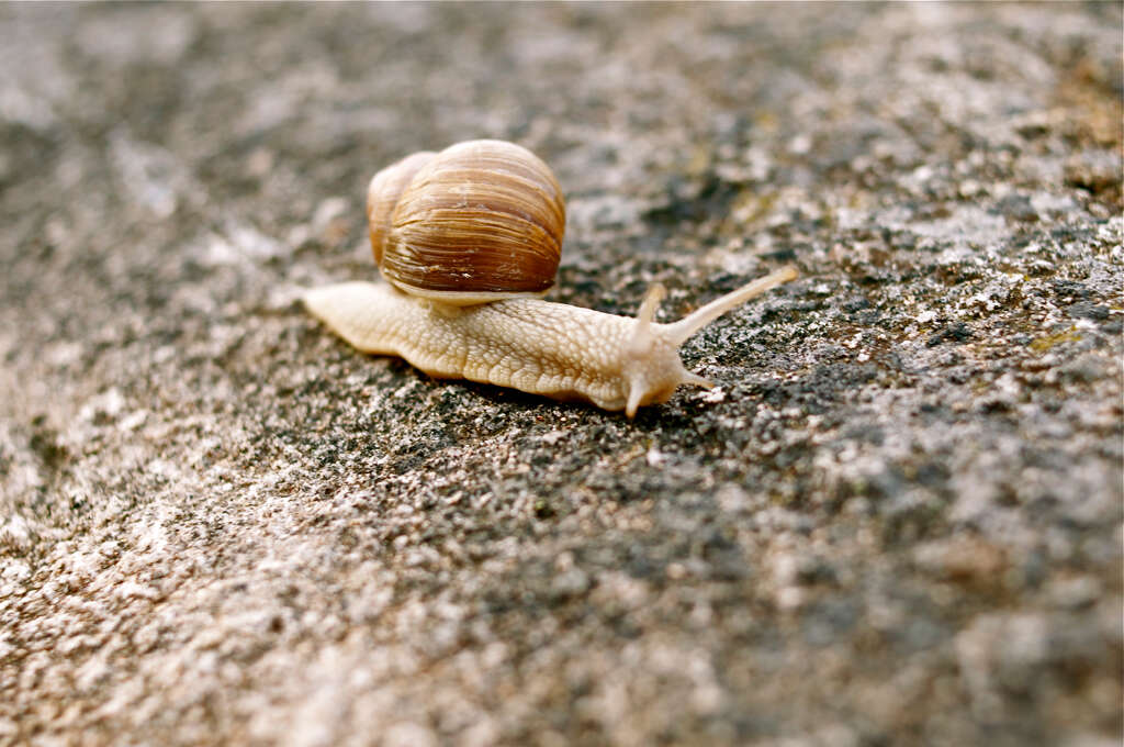 Myxedema