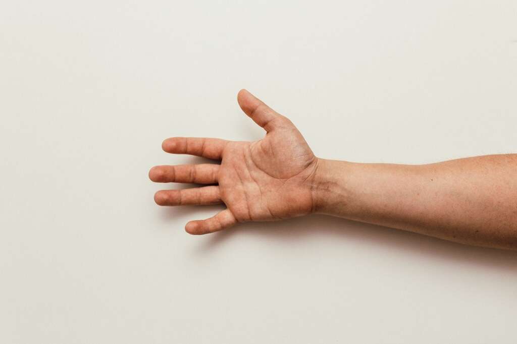 2 fingers on hand numb