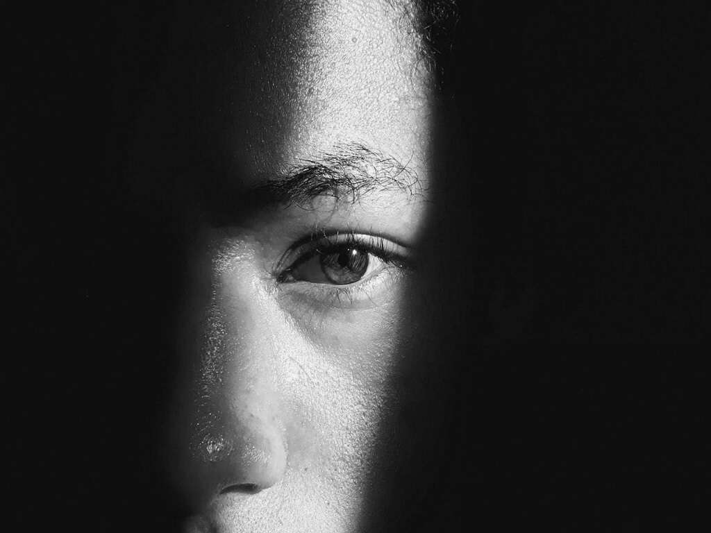 Nystagmus