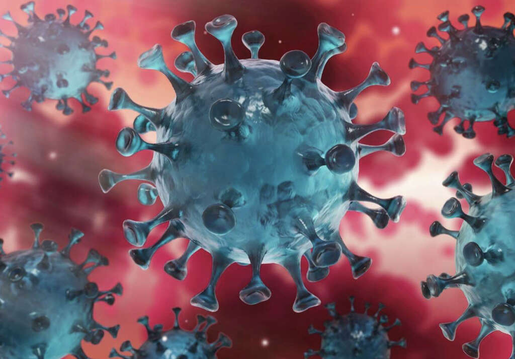 Pneumonia