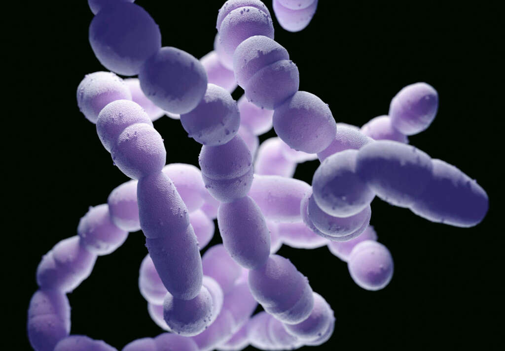 Pneumonia