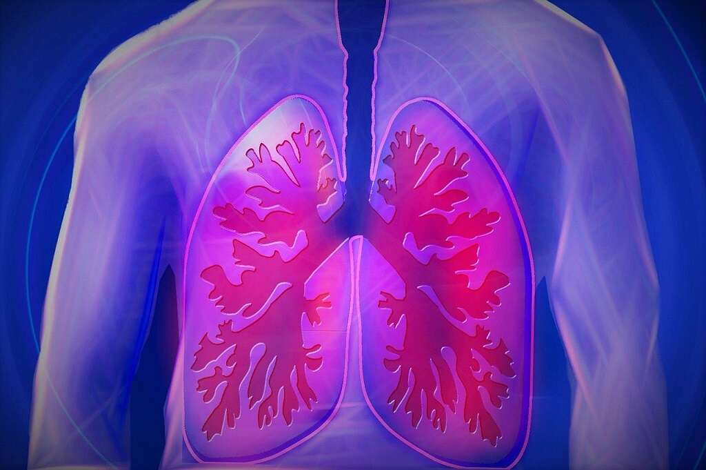 Polymyositis