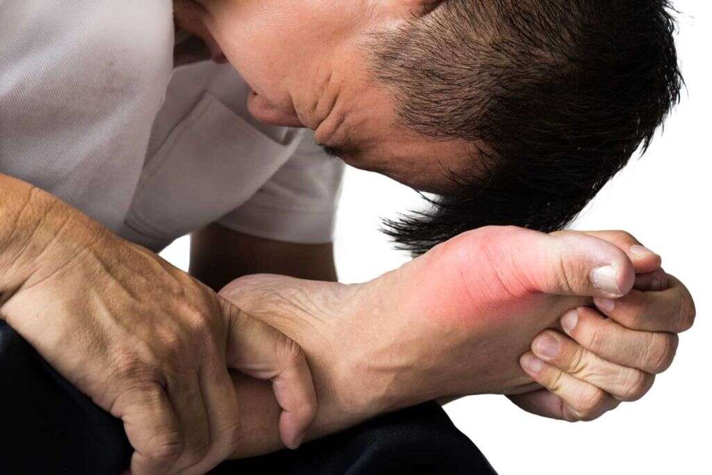 Rheumatoid Arthritis