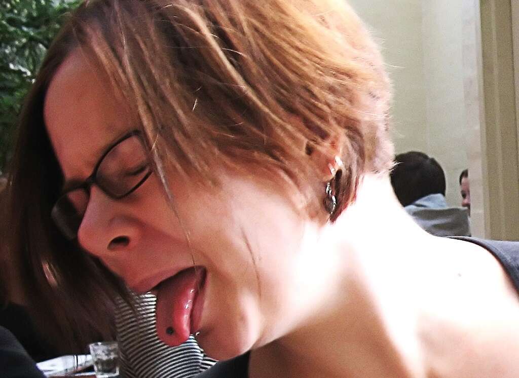 Tonsil Stones