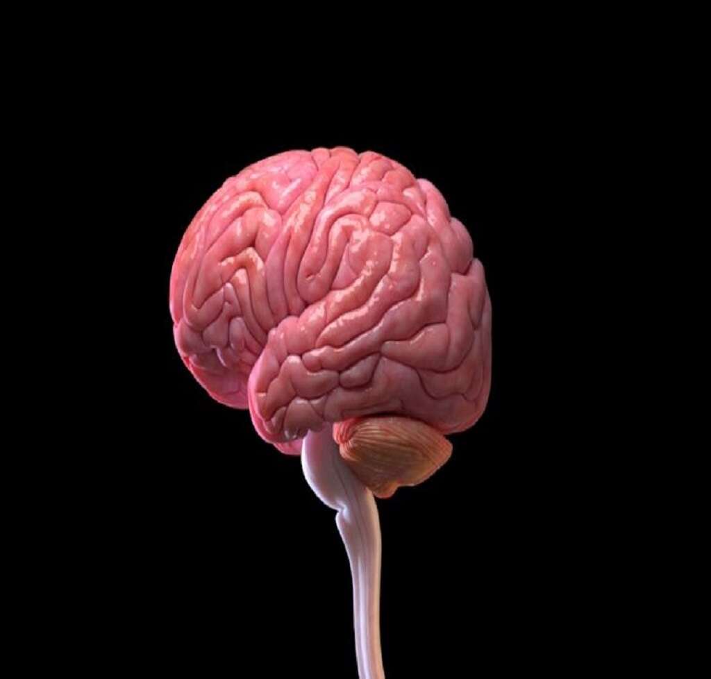 Anencephaly