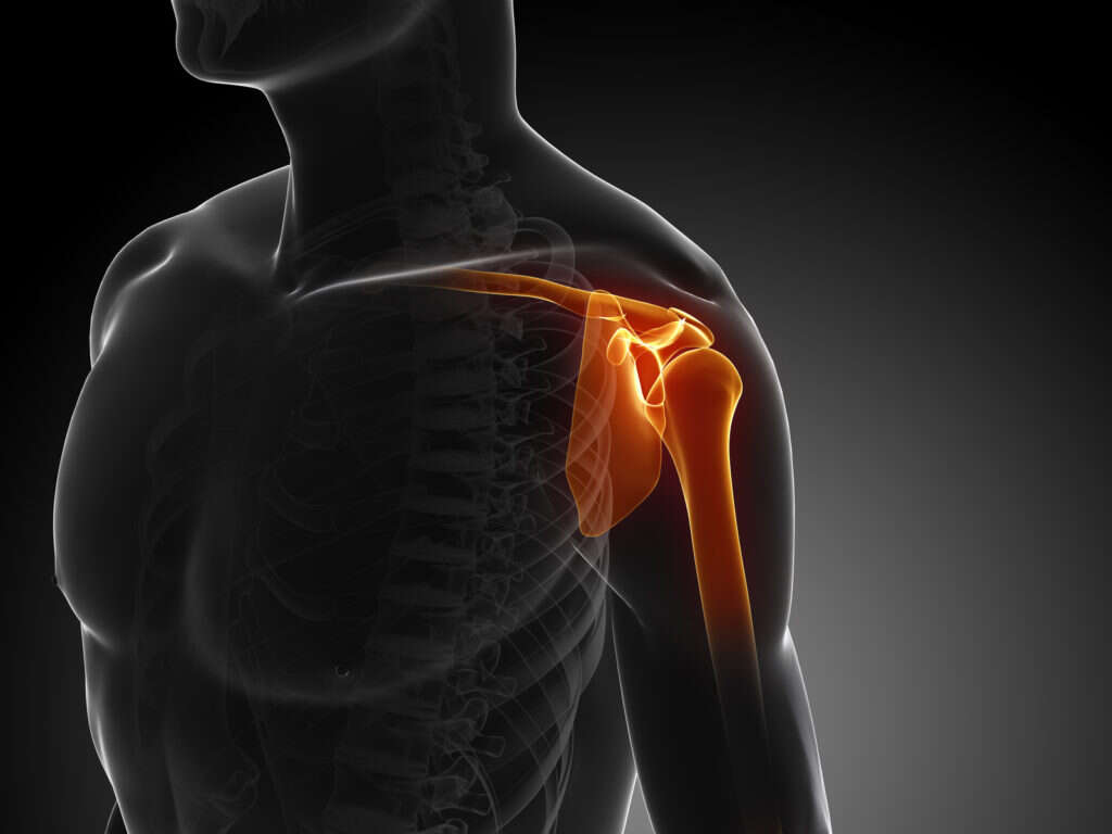 Arm Pain