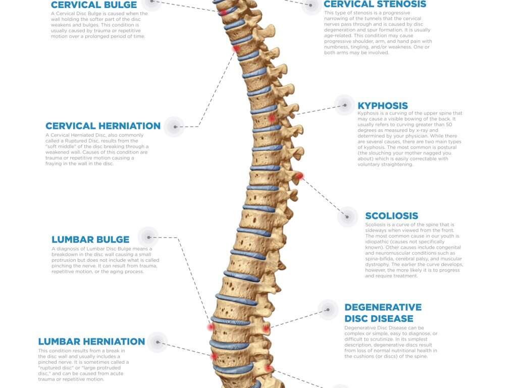 Arm Pain