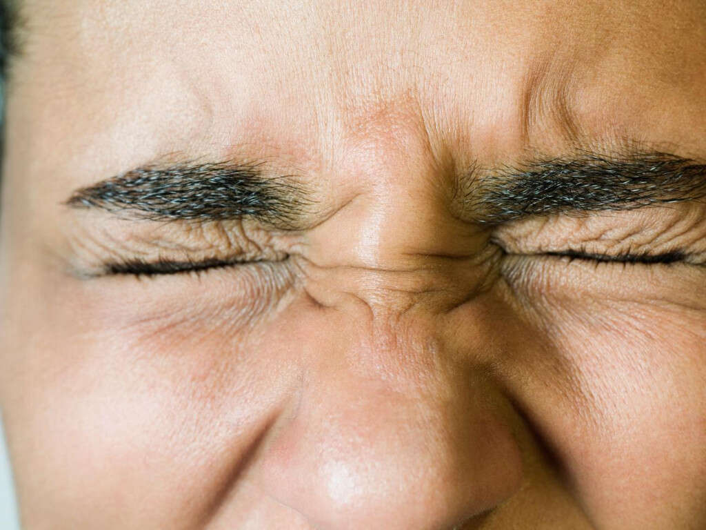 Bell's Palsy