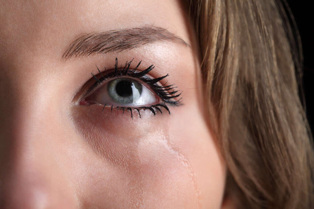 Bell's Palsy