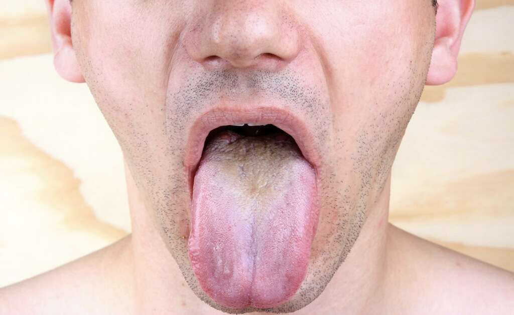 Oil Pulling