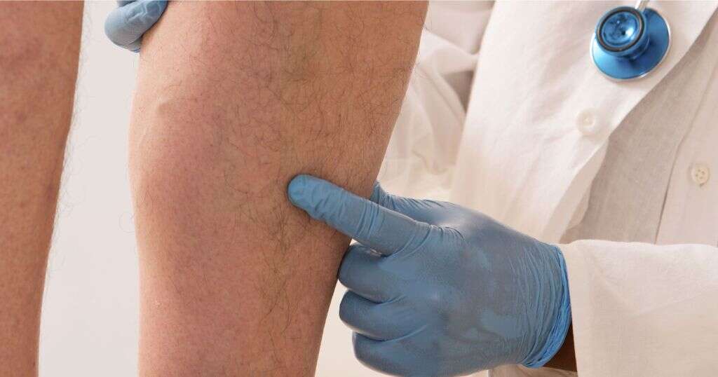 Blood Clot In Leg