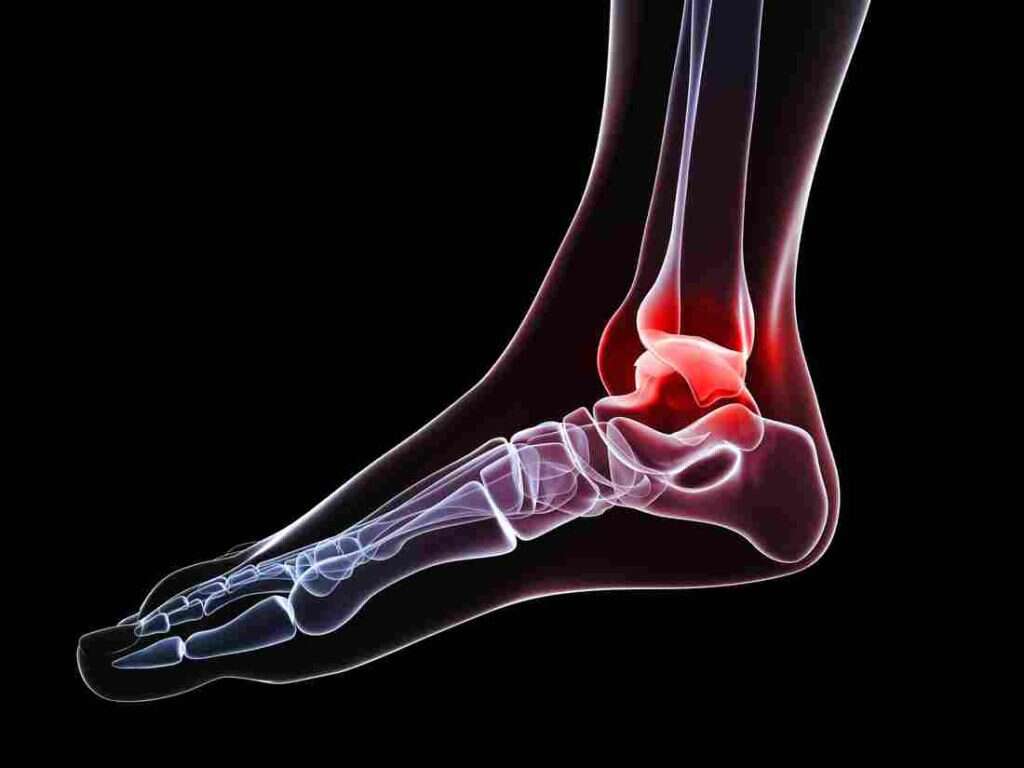 Bone Cancer
