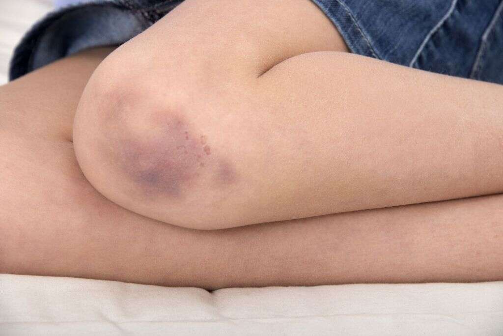 Bone Marrow Cancer