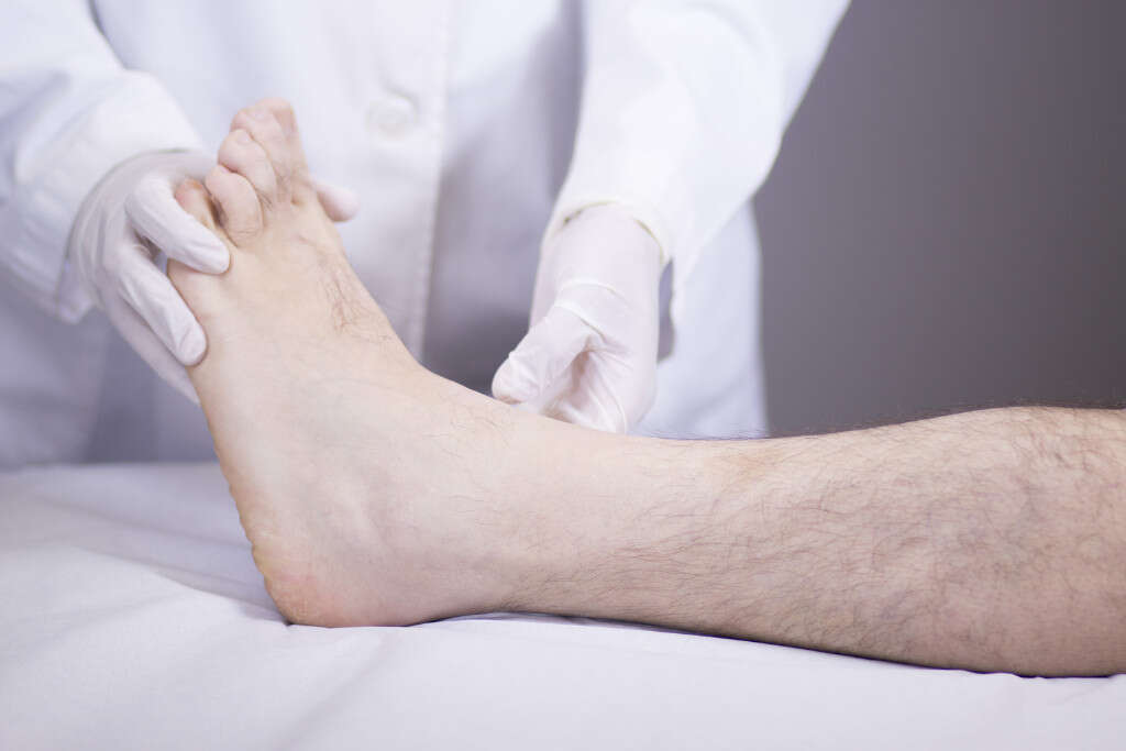 Broken Ankle