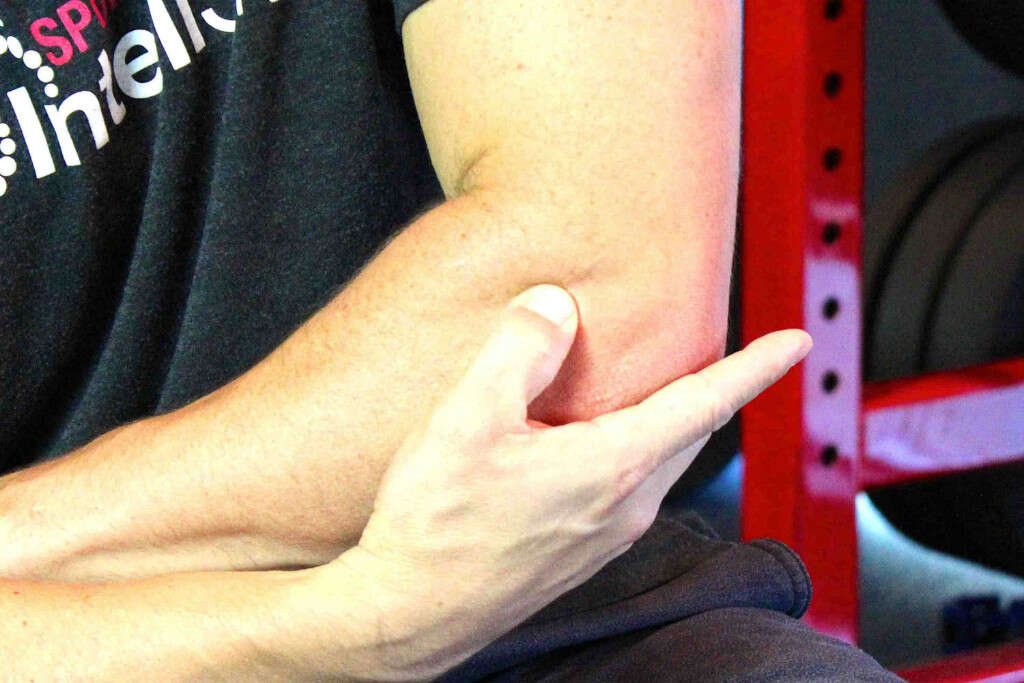 Broken Elbow
