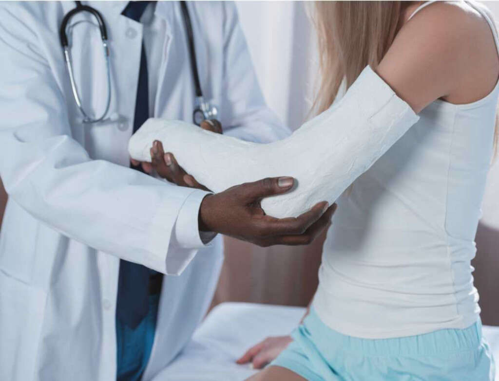 Broken Elbow