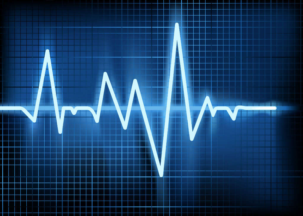 Broken Heart Syndrome