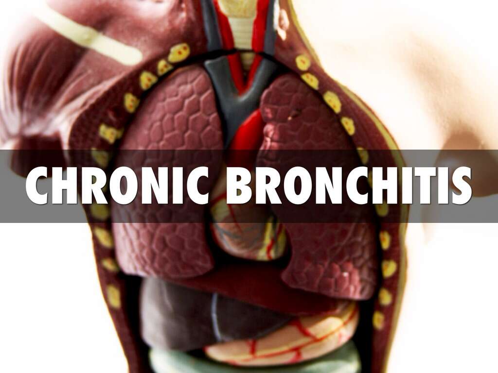 Bronchitis