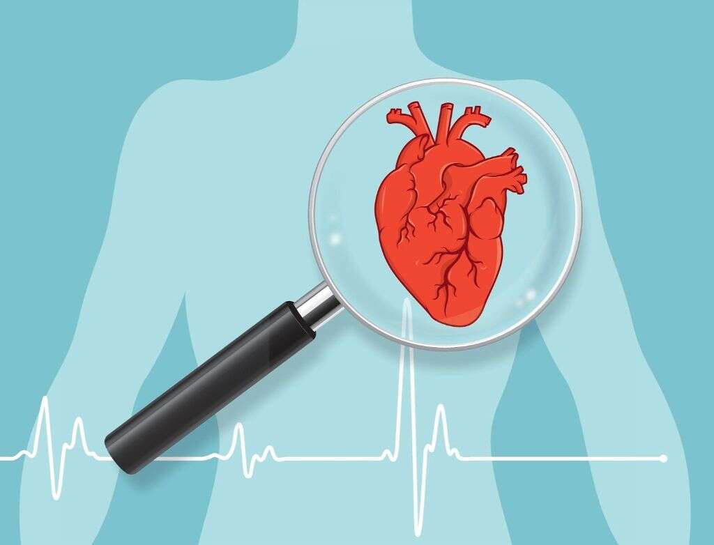 Carcinoid Syndrome