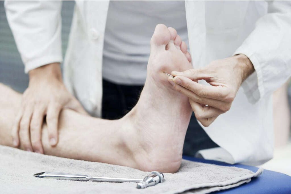 Cauda Equina Syndrome