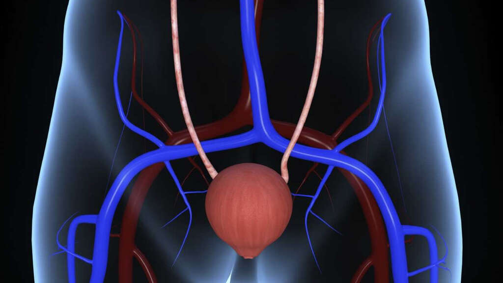 Cauda Equina Syndrome