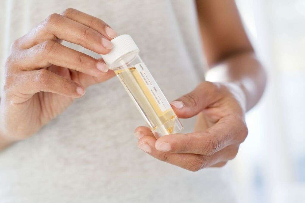 what causes my urine to be cloudy