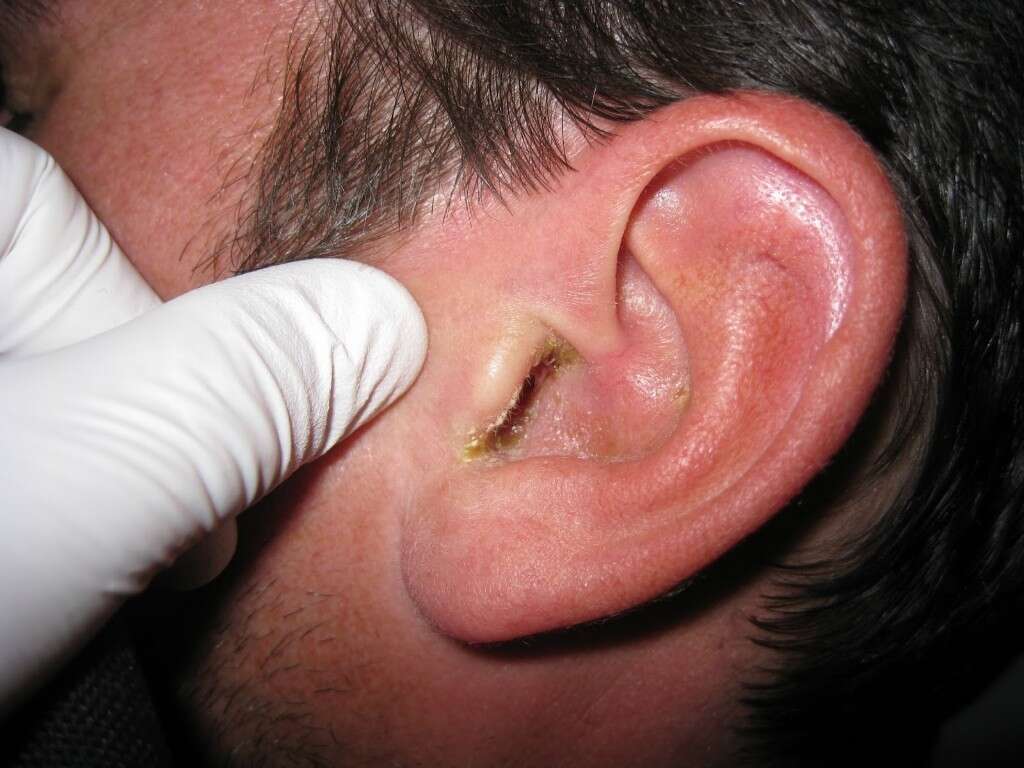 Itchy Ears
