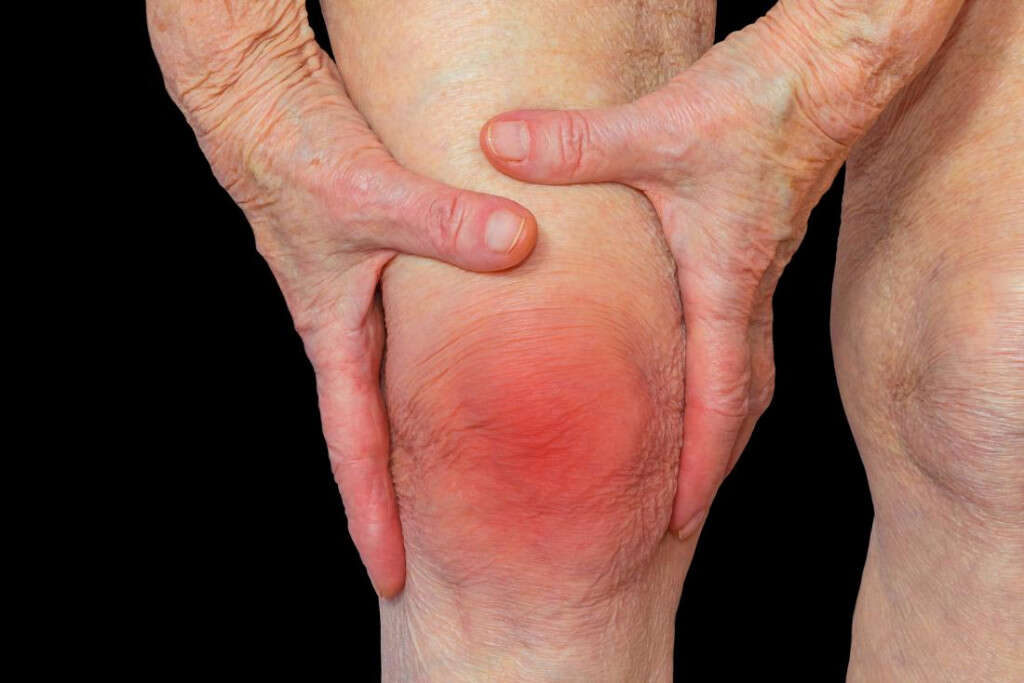 Knee Pain