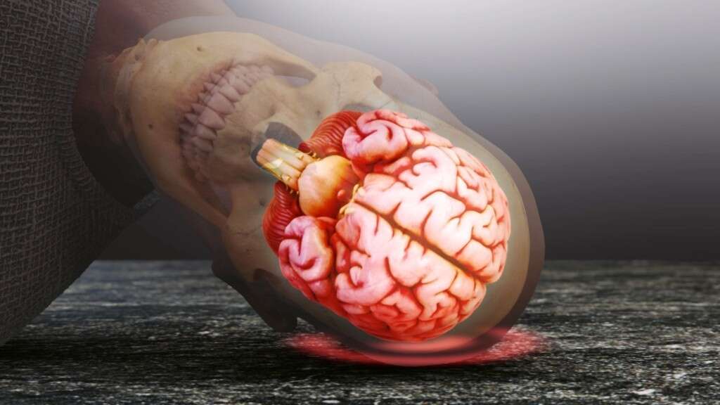 Occipital Neuralgia